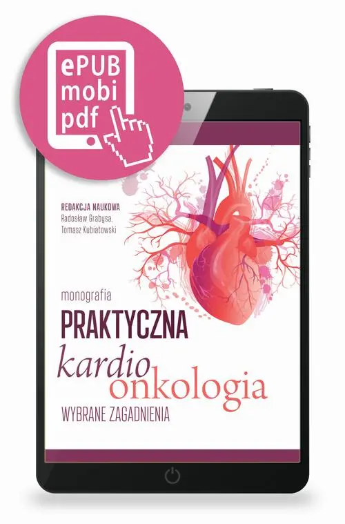 Ebook Praktyczna kardioonkologia - wybrane