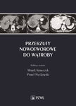 (epub, mobi) Przerzuty nowotworowe do wątroby