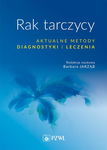 (epub, mobi) Rak tarczycy. Aktualne metody diagnostyki i leczenia