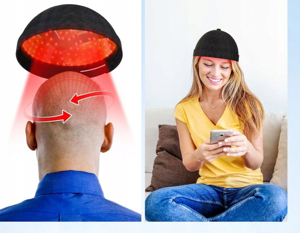 Hełm Laserhelm ModelX czerwone światło stymuluje wzrost włosów